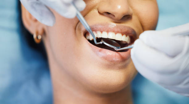 Best Dentist for Tooth Abscess  in Mbrian Park, CA